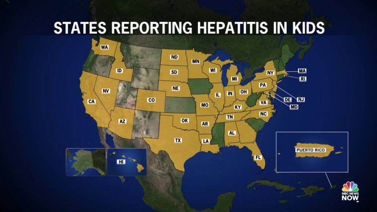 The CDC is still searching for the cause of mysterious liver illness in kids