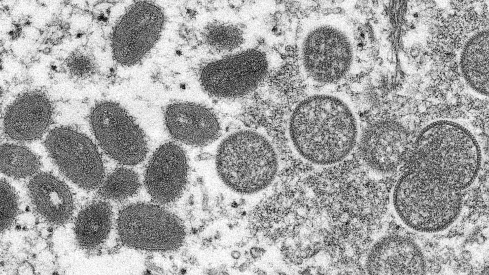 FILE - This 2003 electron microscope image made available by the Centers for Disease Control and Prevention shows mature, oval-shaped monkeypox virions, left, and spherical immature virions, right, obtained from a sample of human skin associated with