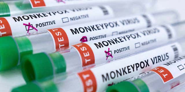 The growth of the monkeypox epidemic might be peaking, British health officials say.