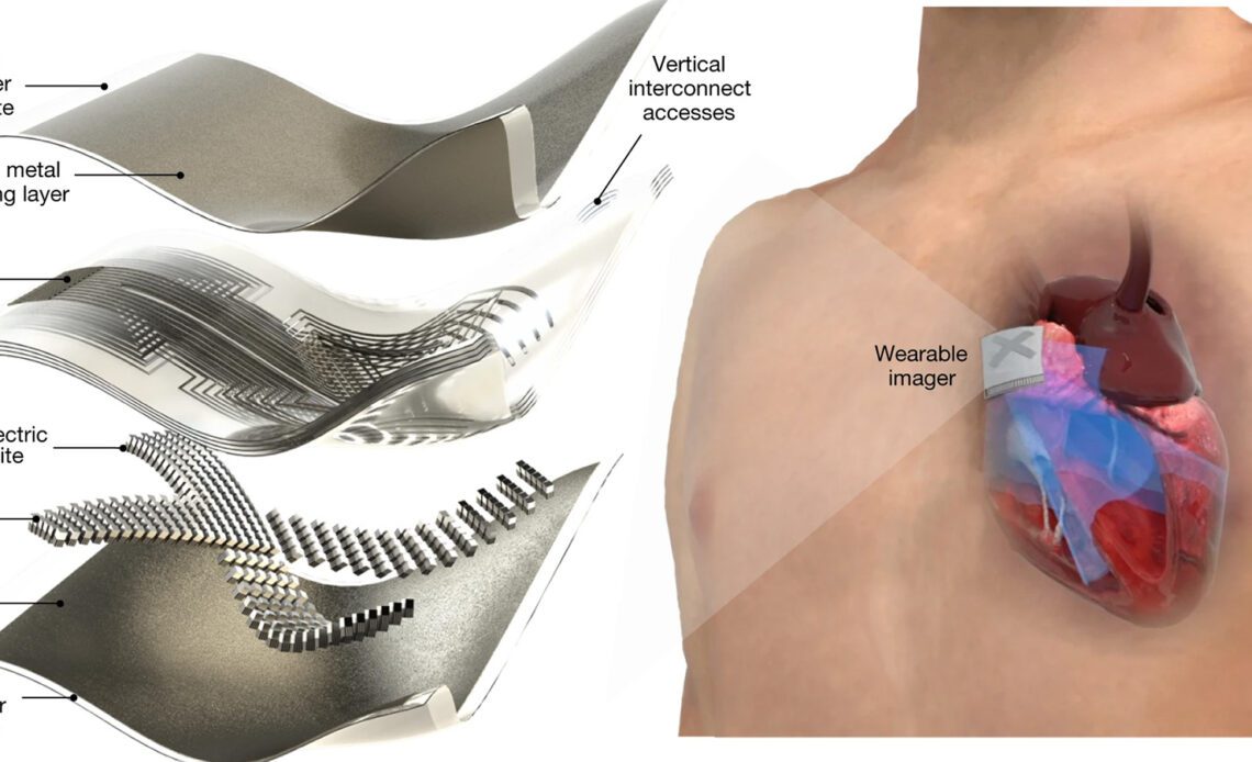 Wearable ultrasound patch could offer real-time heart scans on the go