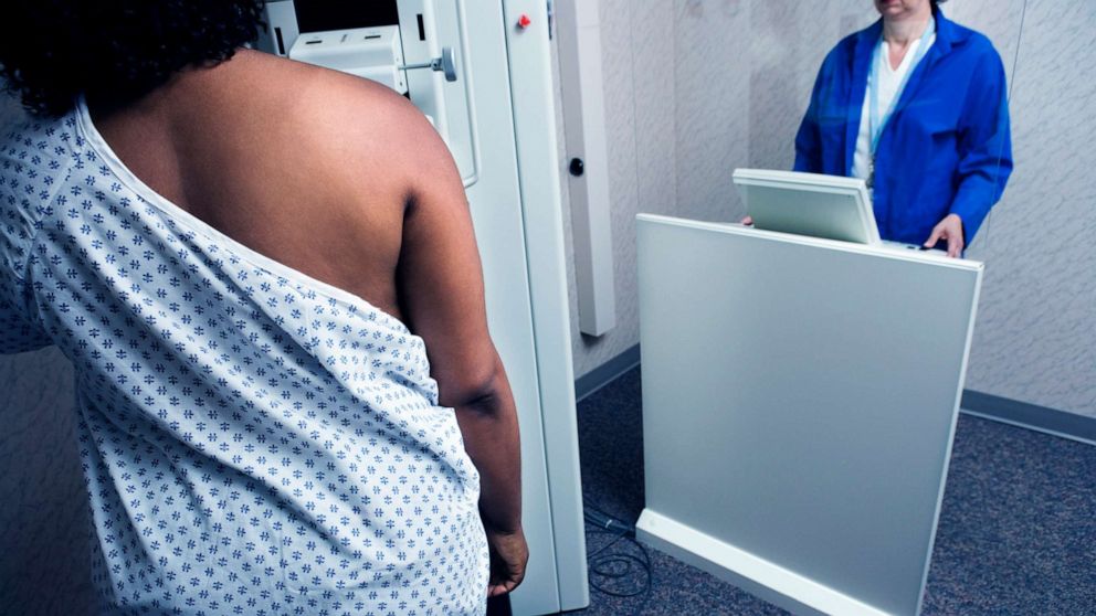 New draft guidance drops breast cancer screening age from 50 to 40 for women with average risk