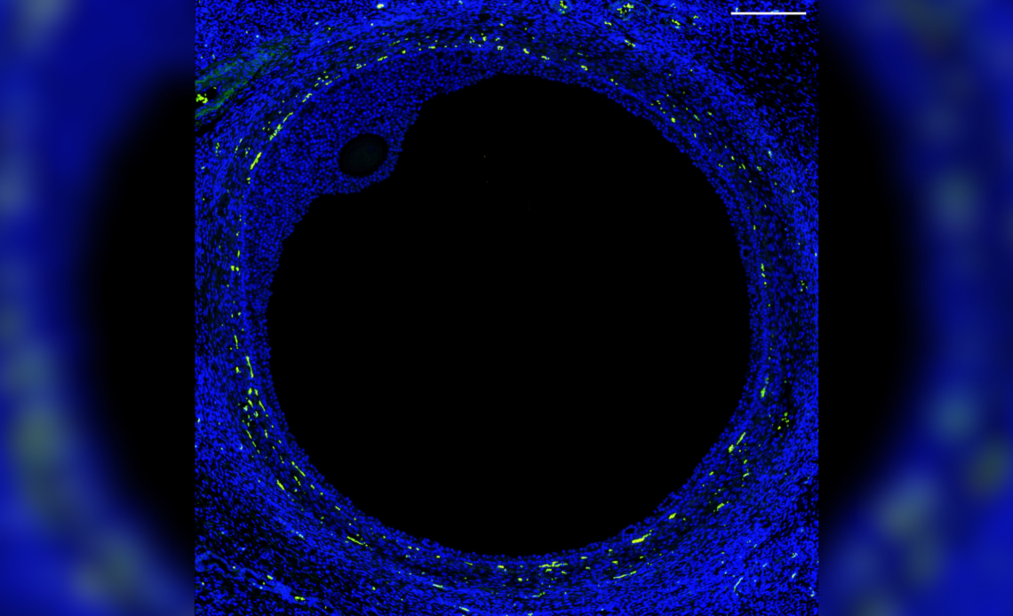 1st 'atlas' of human ovaries could lead to fertility breakthrough, scientists say