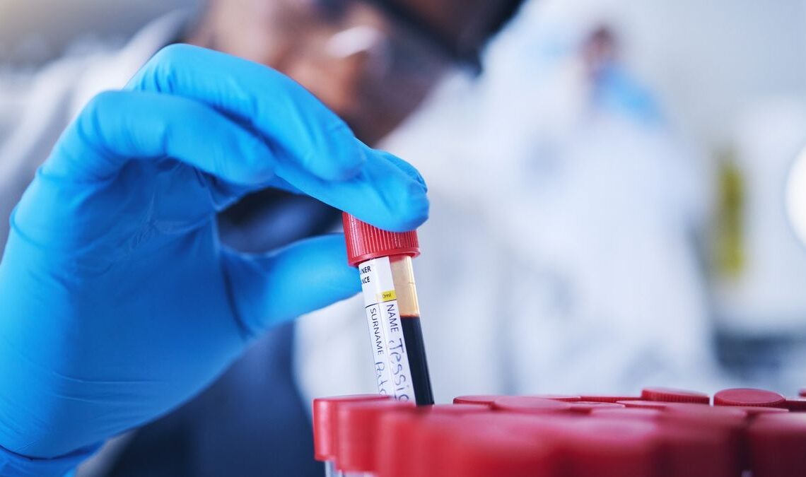 Close-up of a scientist picking up a test tube with a red lid containing blood. The scientists