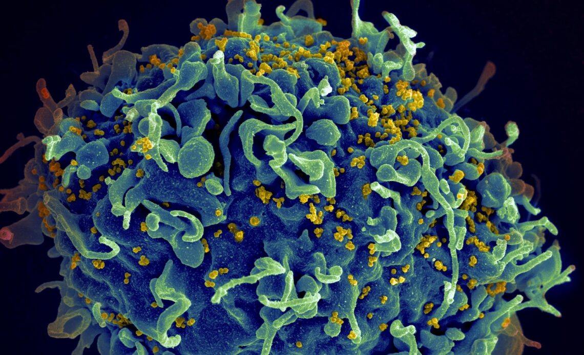 CDC identifies 1st documented cases of HIV transmitted through cosmetic needles