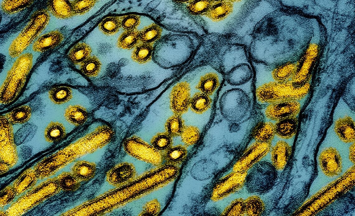 A Canadian teen is in critical condition with what is believed to be bird flu