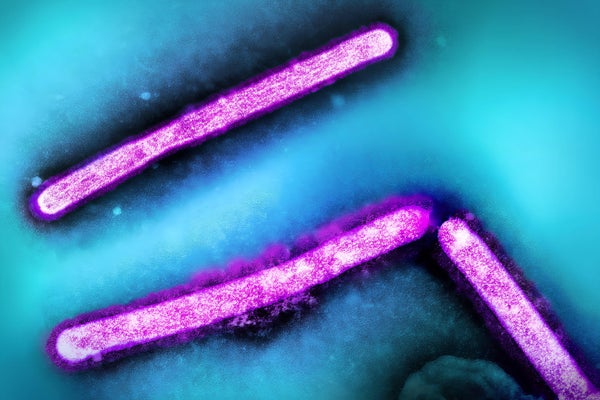 Micrograph of H5N1 virus particles, rod shaped, colorized in pink on a blue background