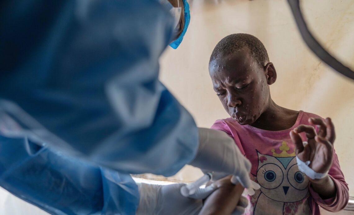 Mpox cases in Congo may be stabilizing. Experts say more vaccines are needed to stamp out virus