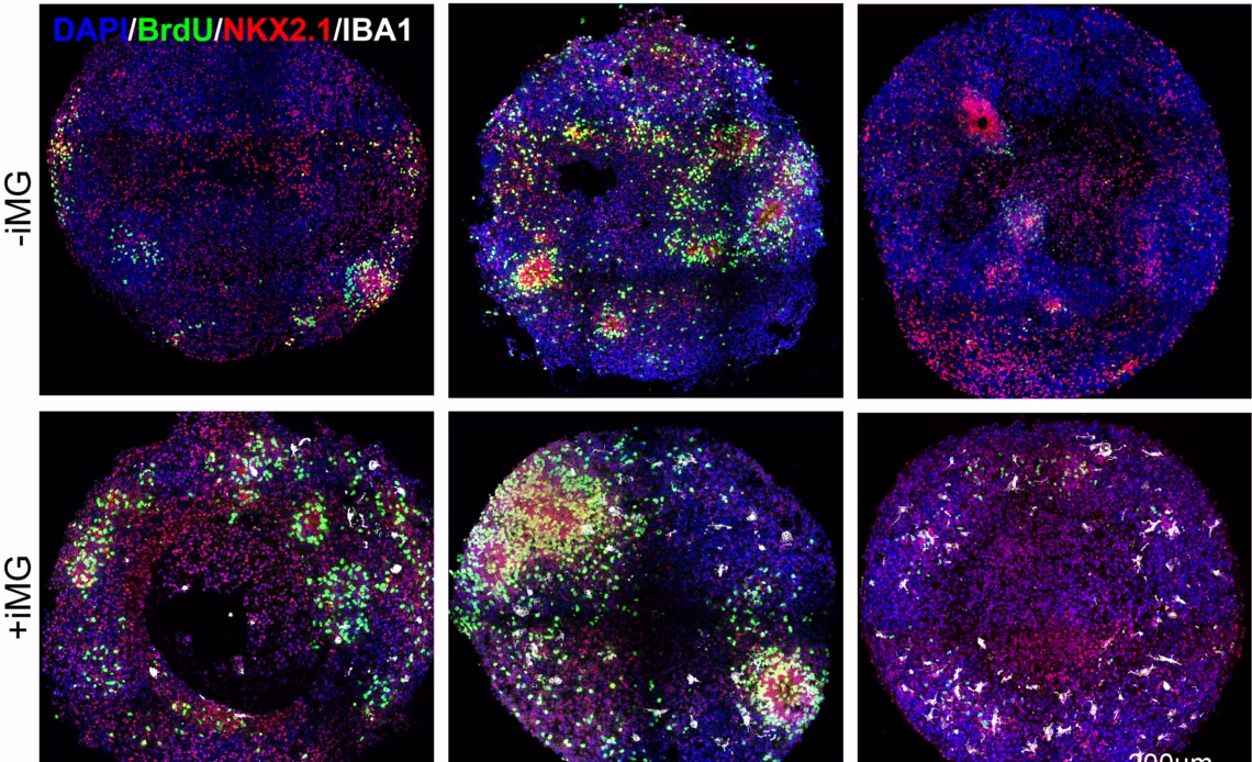 a three by two grid showing images of spherical clumps of cells stained purple, green, red and pink