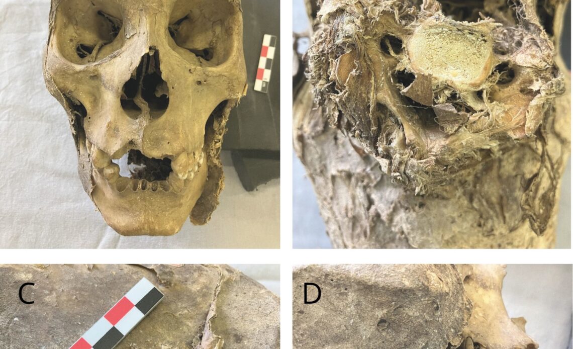 four different detailed angles of the mummified skull
